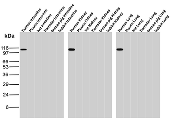 RB1 Antibody