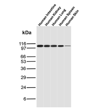 RB1 Antibody