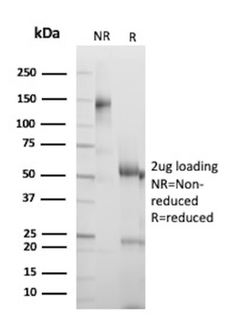 RB1 Antibody