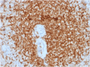BCL2 Antibody