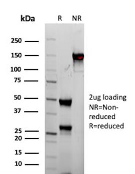 BCL2 Antibody