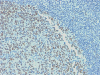 BCL6 Antibody