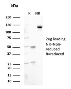 BCL6 Antibody