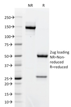 BCL6 Antibody