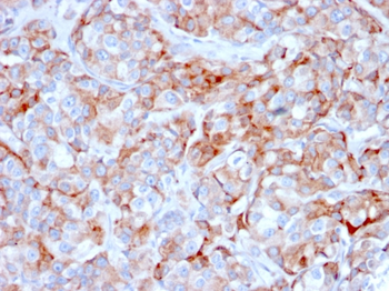 TNFRSF17 Antibody