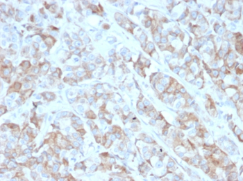 TNFRSF17 Antibody