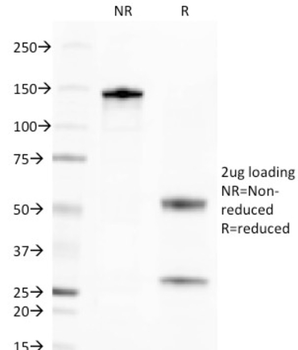 TNFRSF17 Antibody