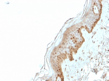 S100A2 Antibody