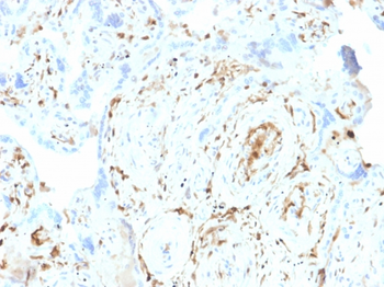 S100A2 Antibody