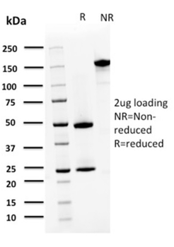 S100A4 Antibody