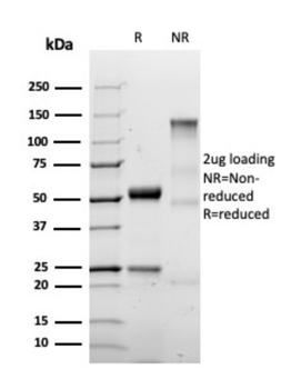 S100A4 Antibody