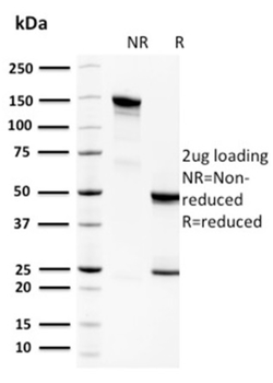 SAT1 Antibody