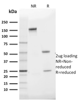 SLC2A1 Antibody