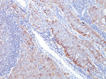 SLC2A1 Antibody