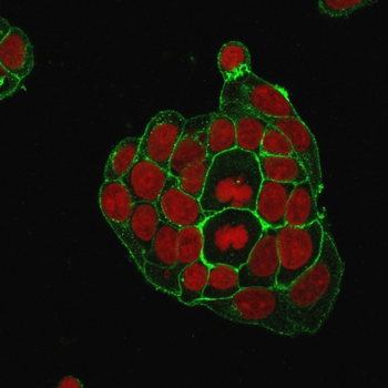 SLC2A1 Antibody