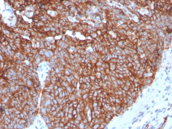 SLC2A1 Antibody
