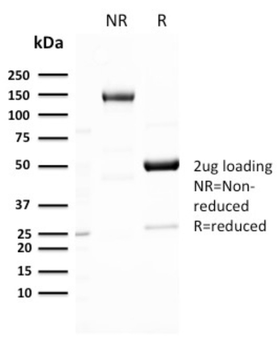 SLC2A1 Antibody