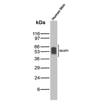 SLC2A1 Antibody