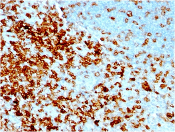 SPN Antibody