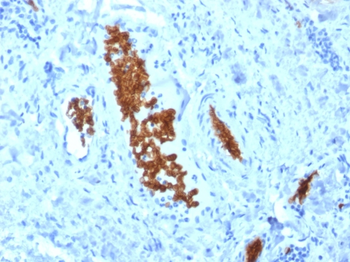 SPTA1 Antibody