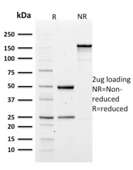 SPTA1 Antibody