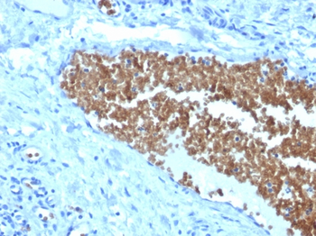 SPTA1 Antibody