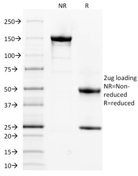 SPTA1 Antibody