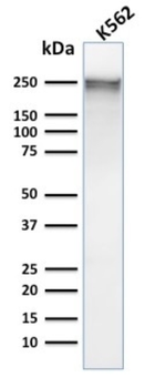 SPTA1 Antibody