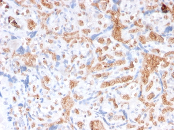 SPTA1 Antibody