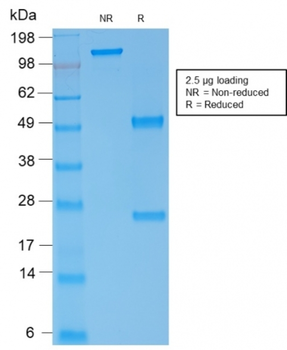 SPTA1 Antibody