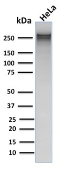 SPTA1 Antibody
