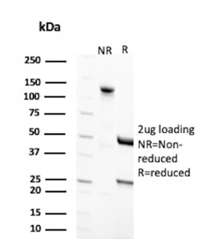SPTA1 Antibody