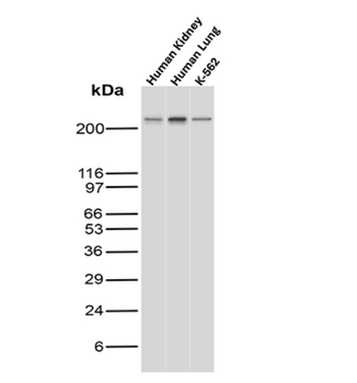 SPTA1 Antibody