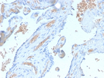 SPTA1 Antibody