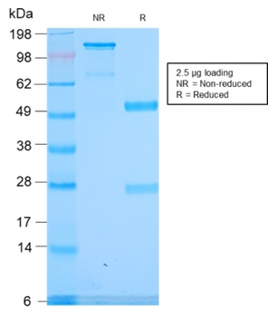 SPTA1 Antibody