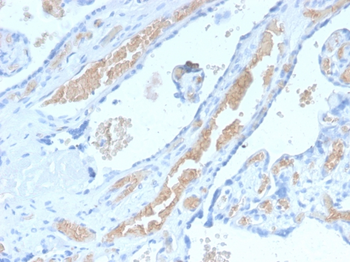 SPTA1 Antibody
