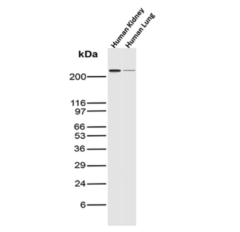 SPTA1 Antibody