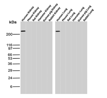 SPTA1 Antibody