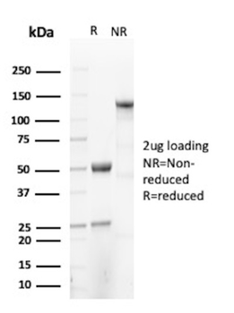 SPTA1 Antibody
