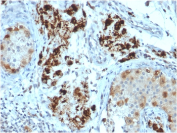 STAR Antibody