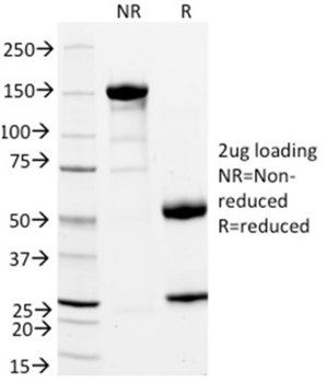STAR Antibody