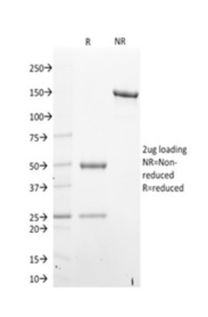 STAT6 Antibody
