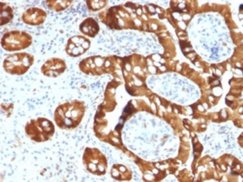 SULT1E1 Antibody