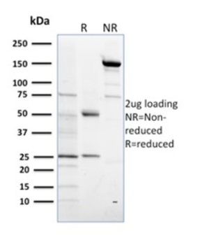 SULT1E1 Antibody