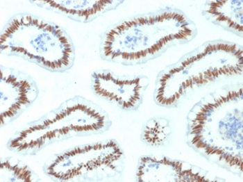 HNF1A Antibody