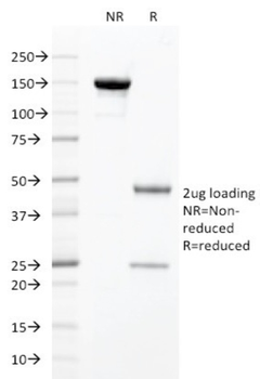 HNF1A Antibody