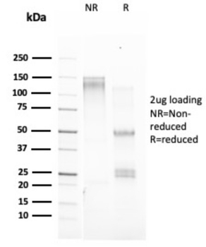 TFF1 Antibody