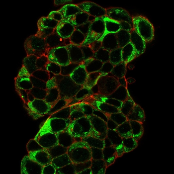 TFF1 Antibody