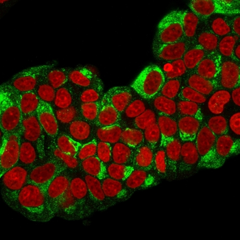 TFF1 Antibody