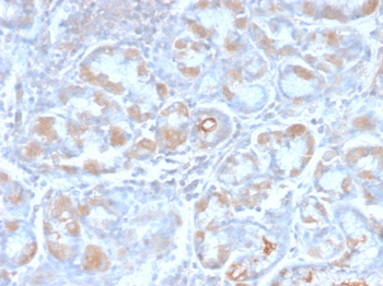 TFF1 Antibody